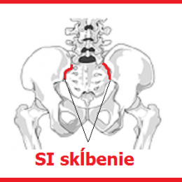 bolesť-sakroiliokálneho-skĺbenia