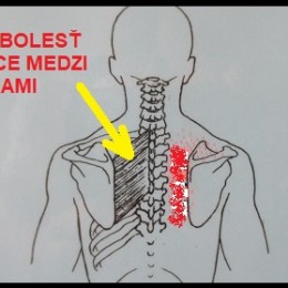 bolest-chrbtice-medzi-lopatkami