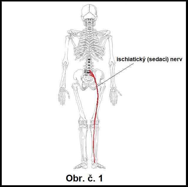 bolesti sedacieho nervu