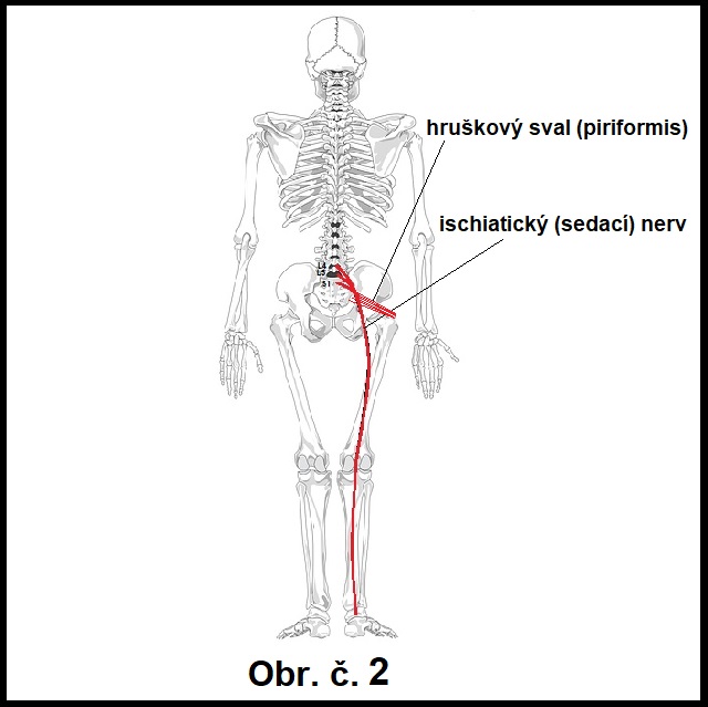 bolesti sedacieho nervu